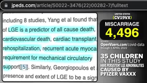 1 HOSPITAL: 35 KIDS HAD CHEST PAIN AND HEART ATTACK SYMPTOMS 3 DAYS AFTER PFIZER