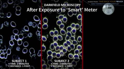 Smart Meter Effects On Blood