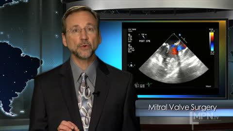 Early Mitral Valve replacement