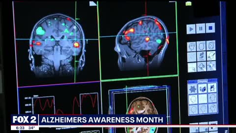 Supplement Memory Health Holds Key to Fighting Alzheimer's Disease