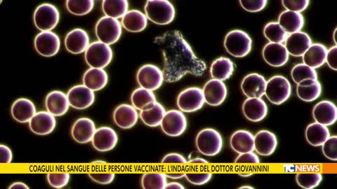 🔴 Coaguli nel sangue dei vaccinati: l’indagine del Dott. Franco Giovannini (10/06/2022)