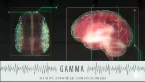 Pineal Gland