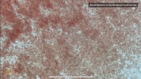 What happens when you add the different Coronavirus shots to in any case solid blood tests