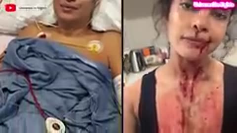 Priyanka Chopra broken after serious inguinal dangerous Accident width