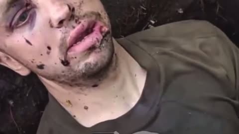 Ukrainian Soldier Captured By Russians Speaks