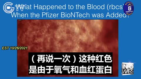 Tests Show Oxygen or Hemoglobin Is Damaged by Dropping Pfizer Vaccine Into Red Blood Cells