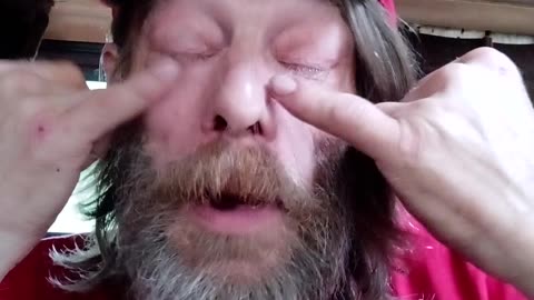 MY FIRST CANNABIS FACIAL CROW'S FEET GONE, VISION RESTORED TO 2020