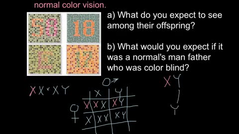 Color blindness: X chromosome linked inheritance