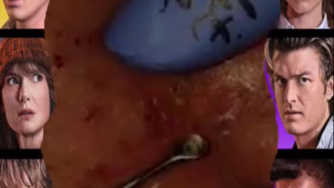 Pimple popping