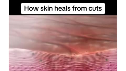 How skin heals from cuts