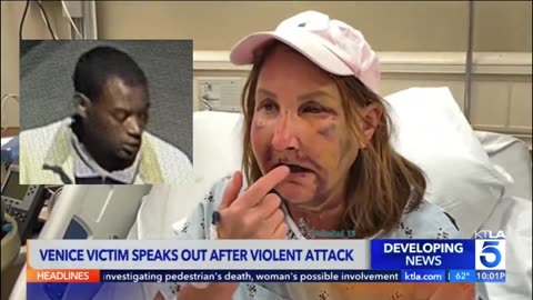 Another disturbing hate crime but it a black male attack white women MSM dont care