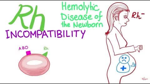 The RH Negative Blood Type: Evidence for alien human hybrid theory? (Rh Null=no Rhesus)