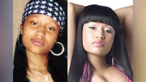 NICKI MINAJ | Before & After Transformation ( Plastic Surgery, Makeup & More )