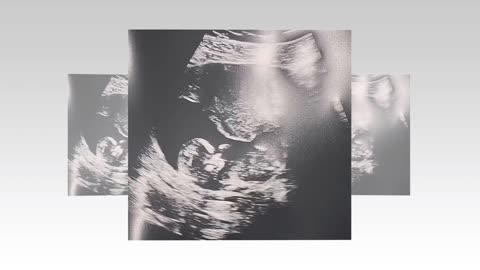 BABY NEWS! Daisy Lowe is Pregnant and Shares Pics of ULTRASOUND#daisy #jordan