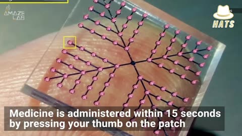 A Skin Patch For Vaccines