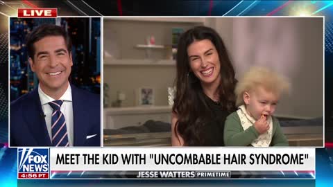 'Did that baby stick his finger in a socket?' -- Meet the boy with 'uncombable hair syndrome'