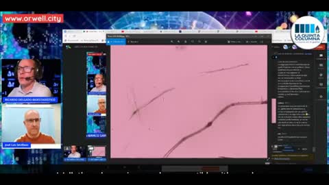 ¡Video exclusivo y fotos de contaminaciòn en Vak... Cov...! Material en microscopio