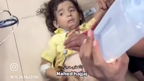 Little Palestinian girl injured in an Israeli air strike that targeted a motorcycle