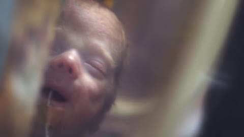 Ad follows inspiring families who had premature babies