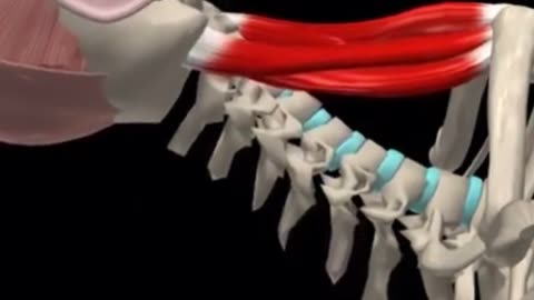 neck pain treatment