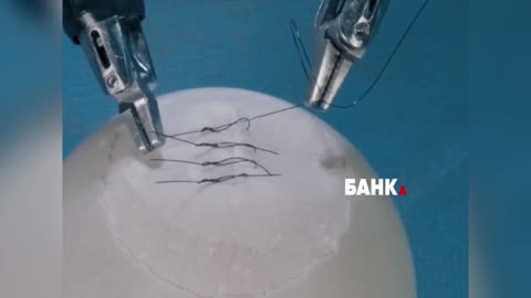 Chinese surgical robots have reached a new level.