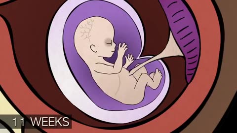 A Realidade Do Aborto 1° Trimestre Cirúrgico Sucção Aborto Aspiração.