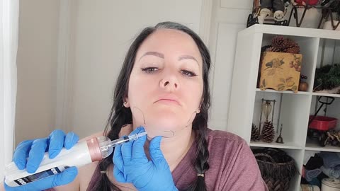 DIY Kybella