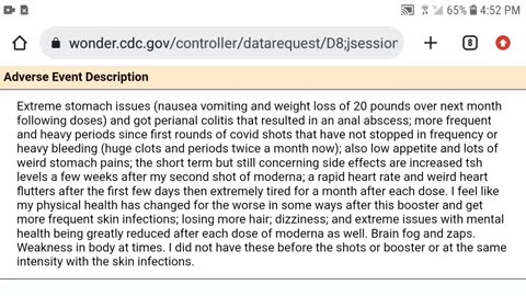 VAERS: 31YR OLD HASN'T HAD ENOUGH SHOTS APPARENTLY! GIVE HER MORE!