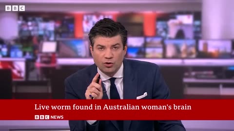 Live worm found in Australian woman's brain - BBC News