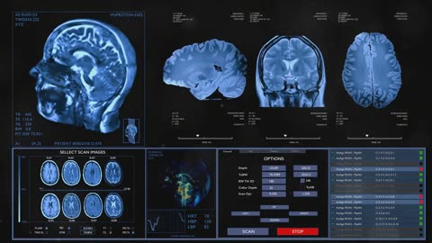 NEURALINK - ELON MUSK VISION OF THE FUTURE