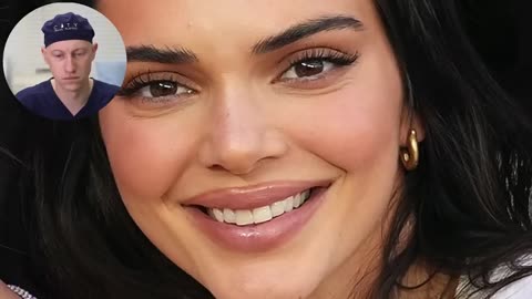 What Happened to Kendall Jenner's Face? | Plastic Surgery Analysis