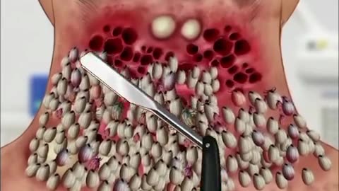 ASMR TREATMENT...3D ANIMATION