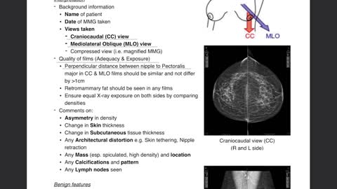 MRCS USMLE Board review Study with me surgery using Goodnotes app Breast surgery 1