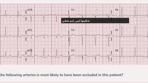 MRCP Pastpaper