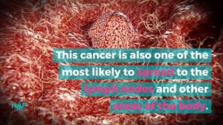 The Most Deadly Forms Of Lung Cancer