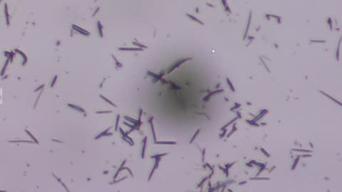 Spike Protein, Graphene Cluster Bomb in the Live Blood Revealed Under pHase Contrast Microscopy [COVID vaccine]