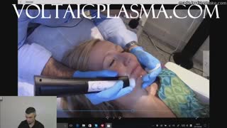 Plasma Skin Tightening Jowl Line