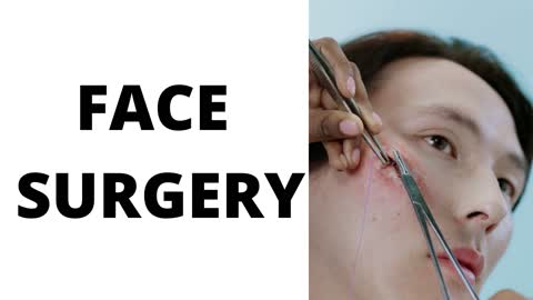 FACE SURGERY