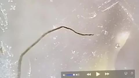 Morgellons Carbon Nanofiber „Pinworm"