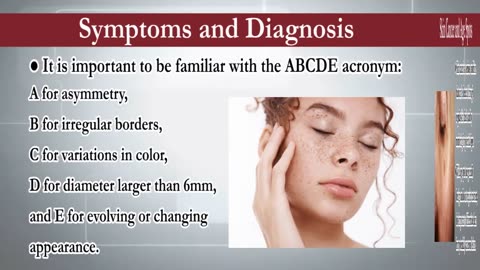 Causes of Brown Spots on Face