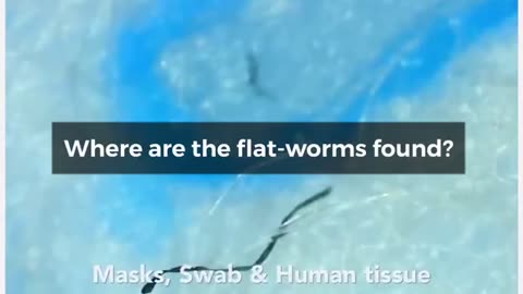 Human Flatworms