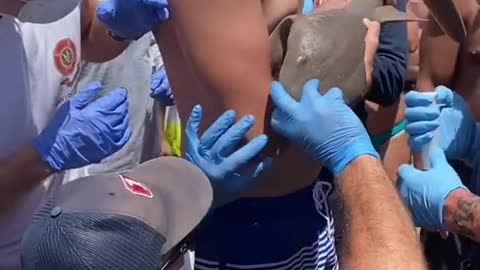 Have you ever seen me get bitten by a shark