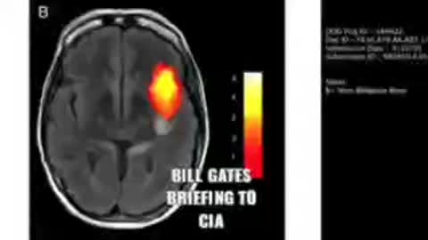 Bill Gates Talks To CIA About Different Parts Of The Brain Being Controlled With Drugs And Vaccines