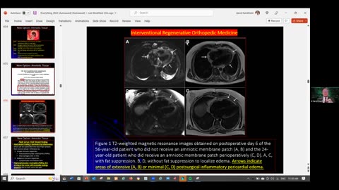 37. Case Studies & Health Q&A