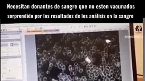 VACUNADOS DEBEN URGENTEMENTE REALIZARSE UNA PRUEBA DE SANDRE DE DIMERO D , SI ES QUE DESEAN SALVAR SUS VIDAS Y PRESENTAMOS COMPARACION DE SANGRE DE VACUNADOS Y NO VACUNADOS