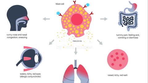 Allergies Uncovered ; Your Body's Overreaction