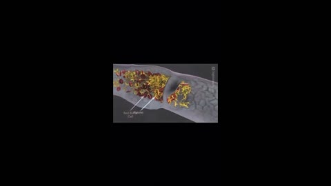 Animated mRNA Vaccine Explanation