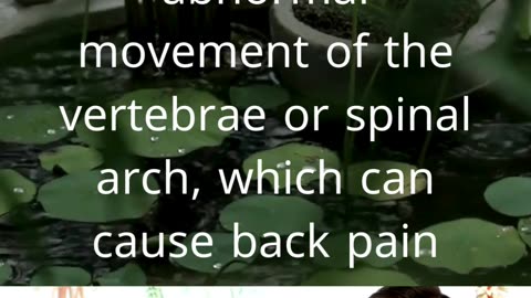 Back pain without a vertebral cause