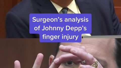 Surgeon's analysis of Johnny Depp's finger injury