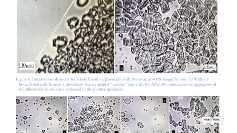 Recent Study Shows Self-Assembly Nanobots in the COVID-19 Injectables